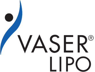 vaser lipo